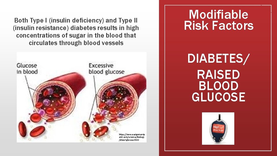 Both Type I (insulin deficiency) and Type II (insulin resistance) diabetes results in high