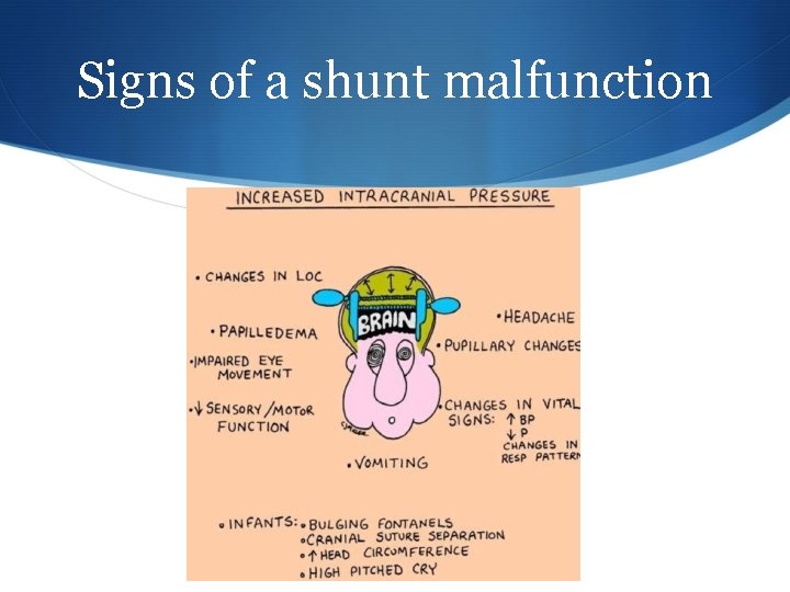 Signs of a shunt malfunction 