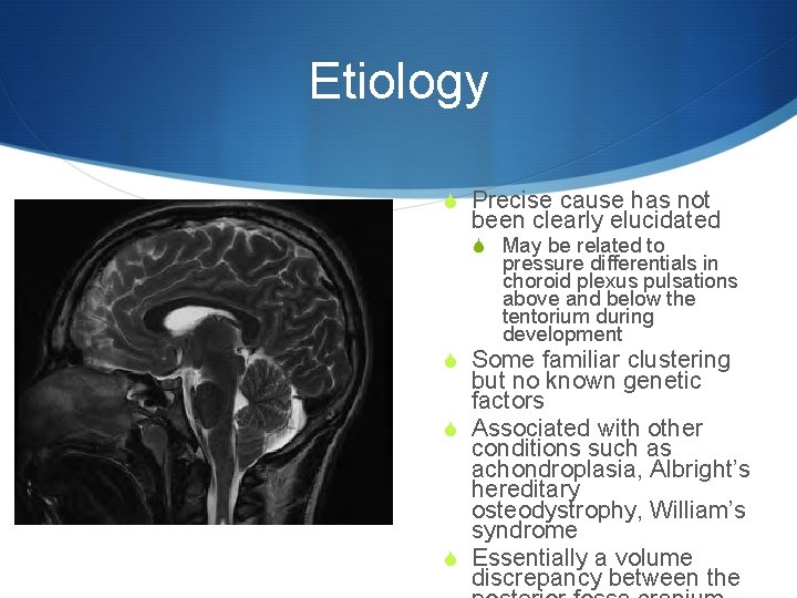 Etiology S Precise cause has not been clearly elucidated S May be related to