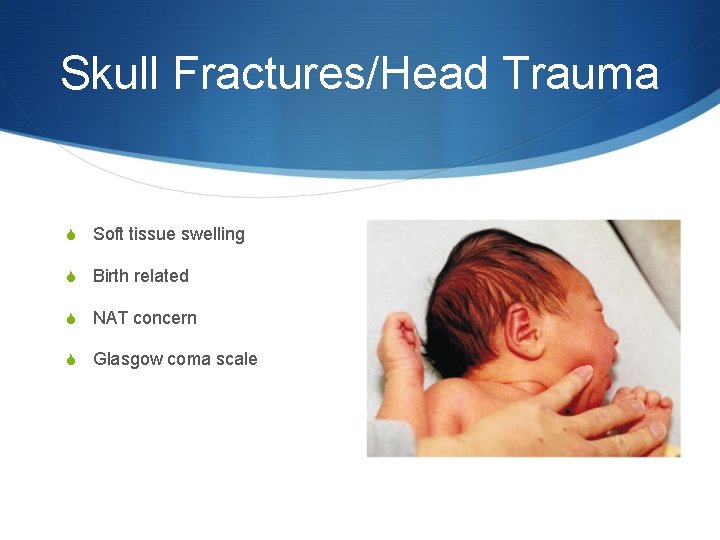 Skull Fractures/Head Trauma S Soft tissue swelling S Birth related S NAT concern S