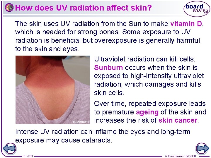 How does UV radiation affect skin? The skin uses UV radiation from the Sun