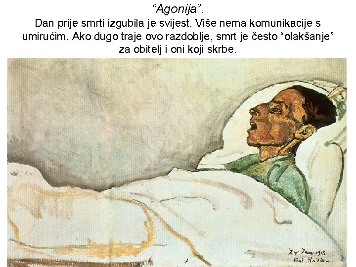 “Agonija”. Dan prije smrti izgubila je svijest. Više nema komunikacije s umirućim. Ako dugo “Agonija”. Dan prije smrti izgubila je svijest. Više nema komunikacije s umirućim. Ako dugo