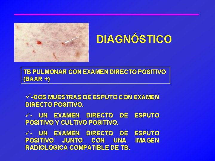 DIAGNÓSTICO TB PULMONAR CON EXAMEN DIRECTO POSITIVO (BAAR +) ü-DOS MUESTRAS DE ESPUTO CON