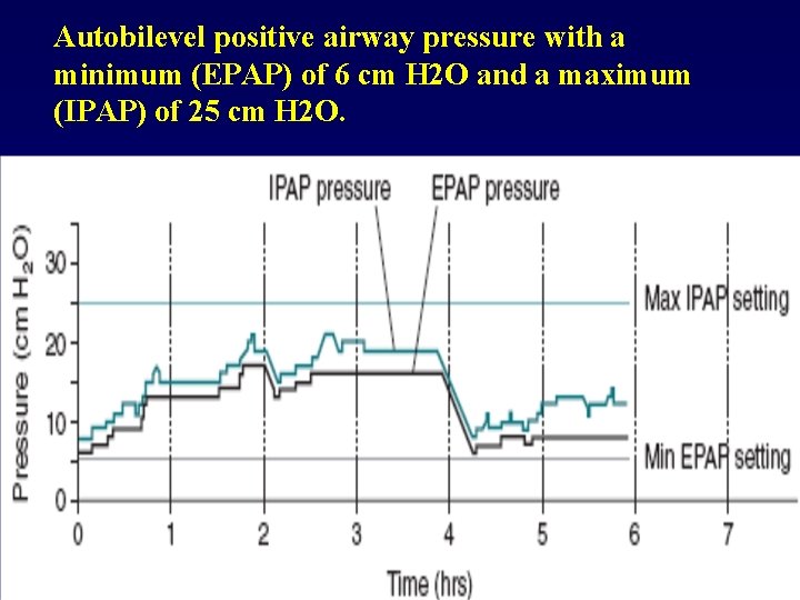 Autobilevel positive airway pressure with a minimum (EPAP) of 6 cm H 2 O