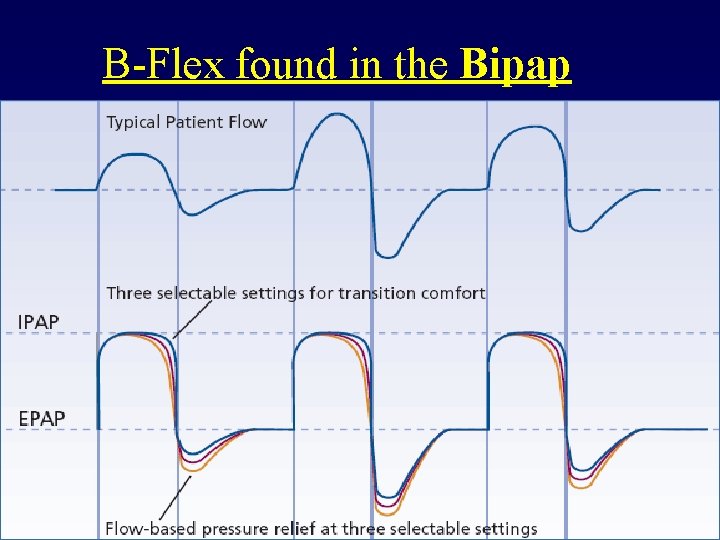 B-Flex found in the Bipap 