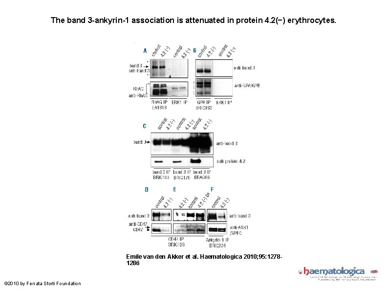 The band 3 -ankyrin-1 association is attenuated in protein 4. 2(−) erythrocytes. Emile van