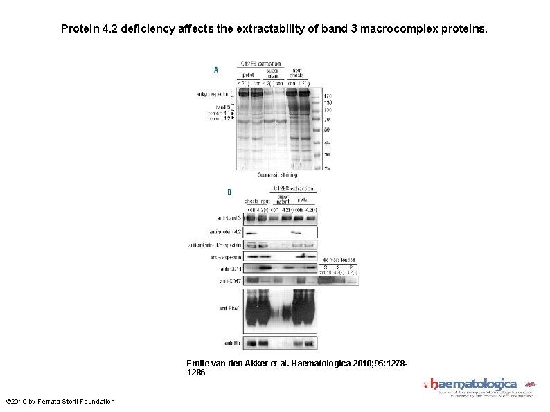 Protein 4. 2 deficiency affects the extractability of band 3 macrocomplex proteins. Emile van