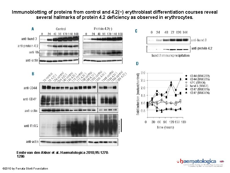 Immunoblotting of proteins from control and 4. 2(−) erythroblast differentiation courses reveal several hallmarks