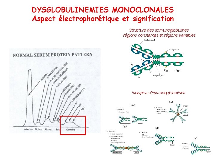 DYSGLOBULINEMIES MONOCLONALES Aspect électrophorétique et signification Structure des immunoglobulines régions constantes et régions variables