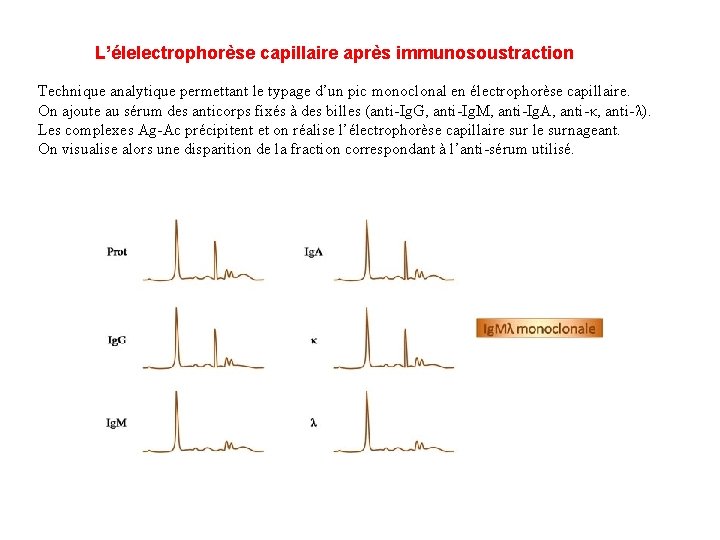 L’élelectrophorèse capillaire après immunosoustraction Technique analytique permettant le typage d’un pic monoclonal en électrophorèse