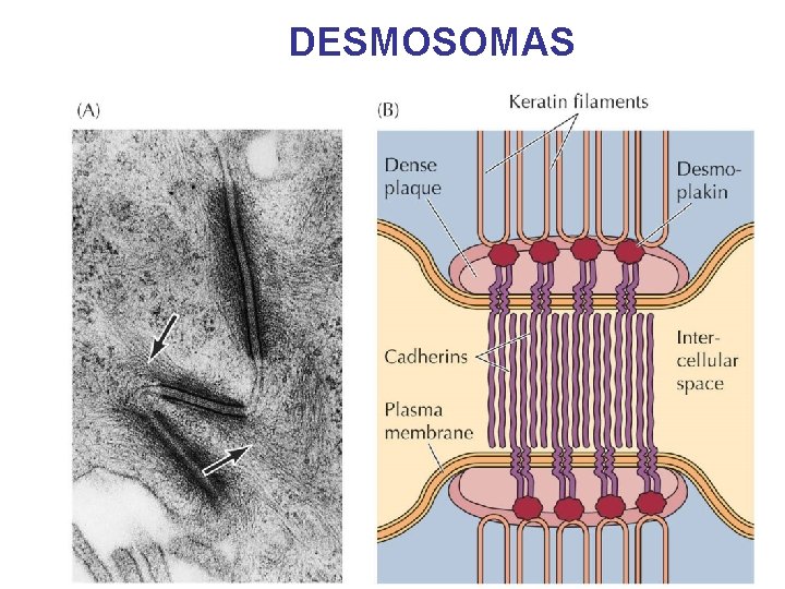 DESMOSOMAS 