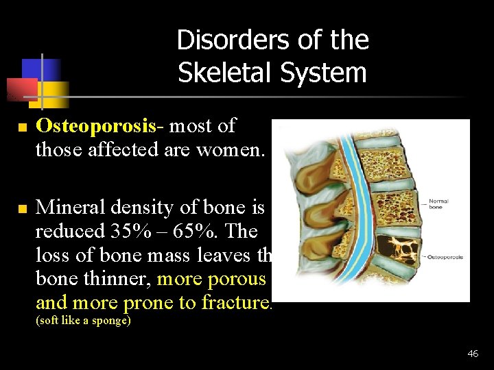 Disorders of the Skeletal System n n Osteoporosis- most of those affected are women.