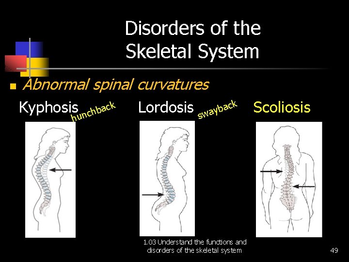Disorders of the Skeletal System n Abnormal spinal curvatures Kyphosis nchback hu Lordosis ck