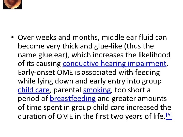  • Over weeks and months, middle ear fluid can become very thick and
