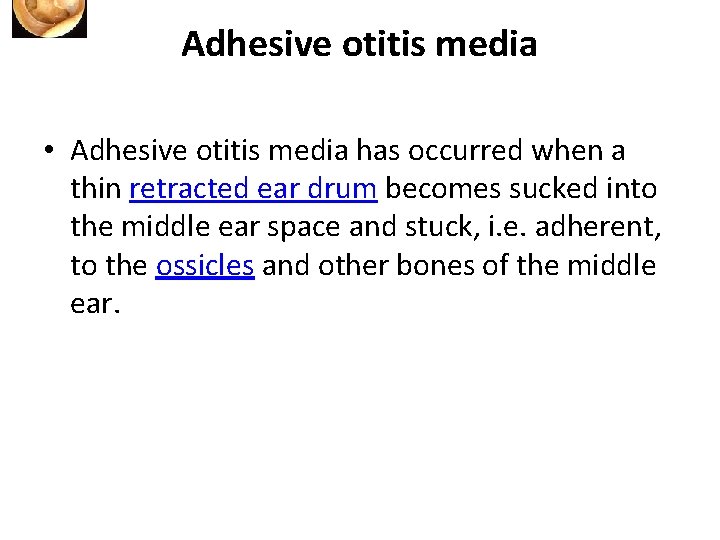 Adhesive otitis media • Adhesive otitis media has occurred when a thin retracted ear