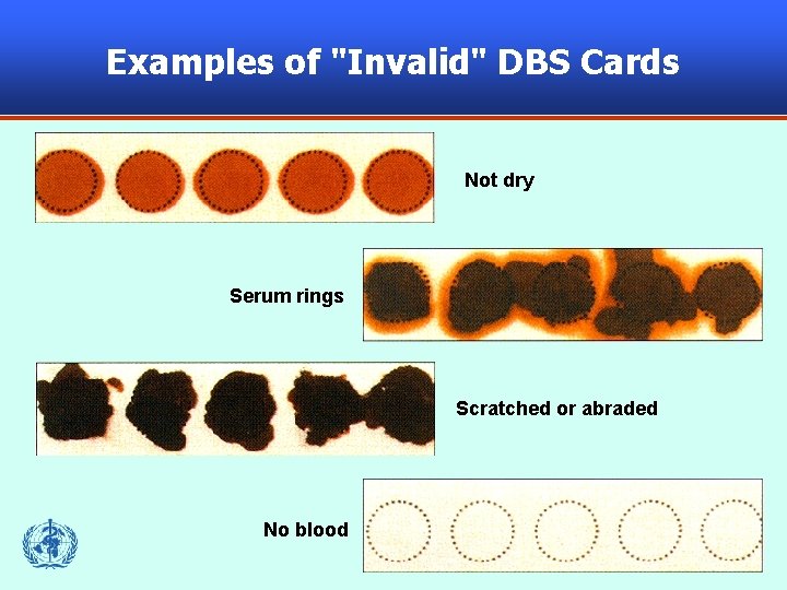 Examples of "Invalid" DBS Cards Not dry Serum rings Scratched or abraded No blood