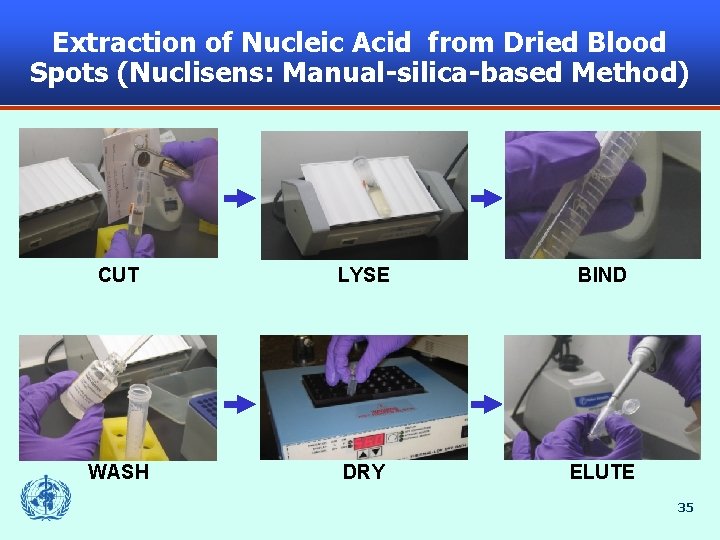 Extraction of Nucleic Acid from Dried Blood Spots (Nuclisens: Manual-silica-based Method) CUT LYSE BIND