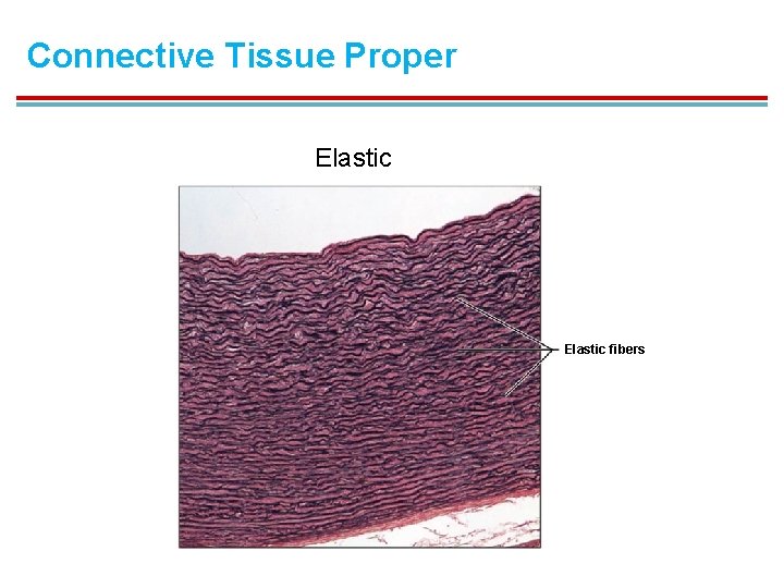 Connective Tissue Proper Elastic fibers 