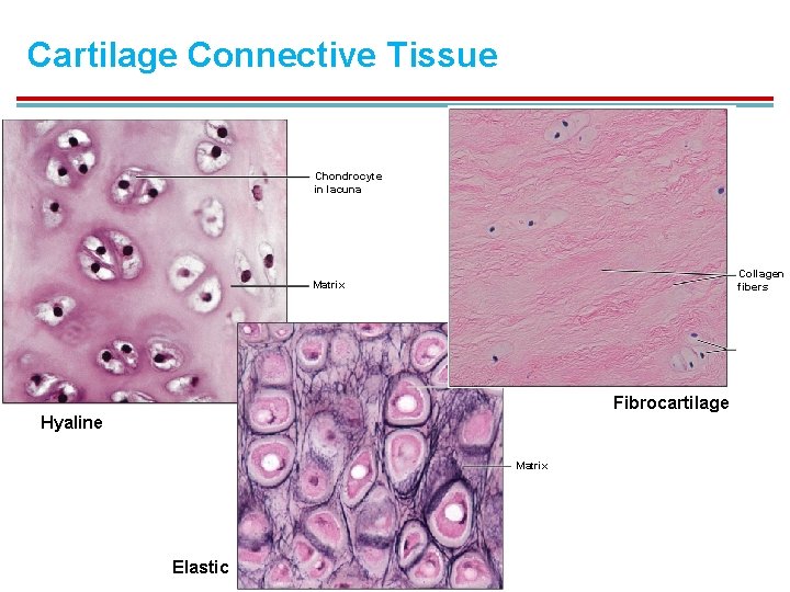 Cartilage Connective Tissue Chondrocyte in lacuna Collagen fibers Matrix Fibrocartilage Hyaline Matrix Elastic 