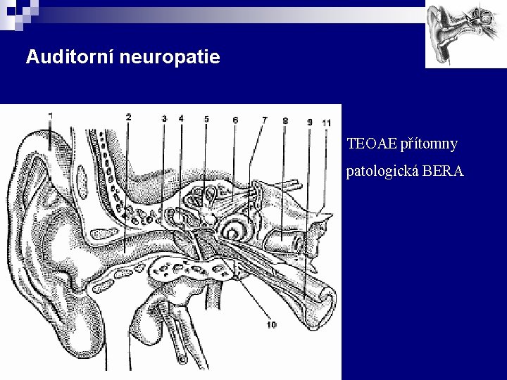 Auditorní neuropatie TEOAE přítomny patologická BERA 