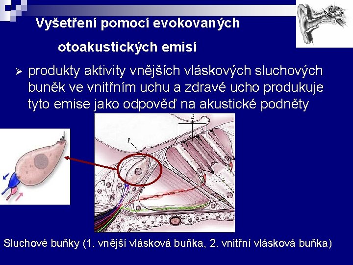 Vyšetření pomocí evokovaných otoakustických emisí Ø produkty aktivity vnějších vláskových sluchových buněk ve vnitřním