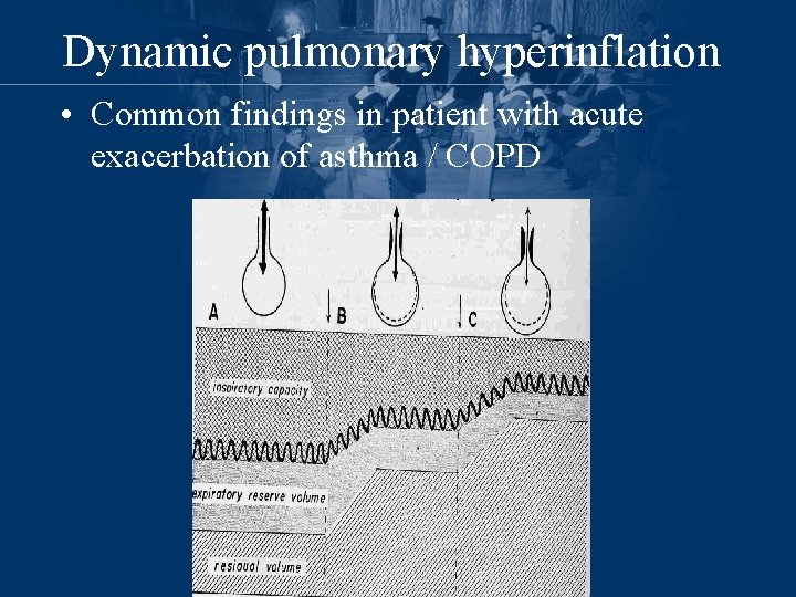 Dynamic pulmonary hyperinflation • Common findings in patient with acute exacerbation of asthma /