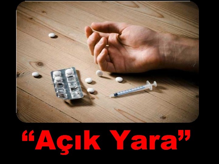 “Açık Yara” 