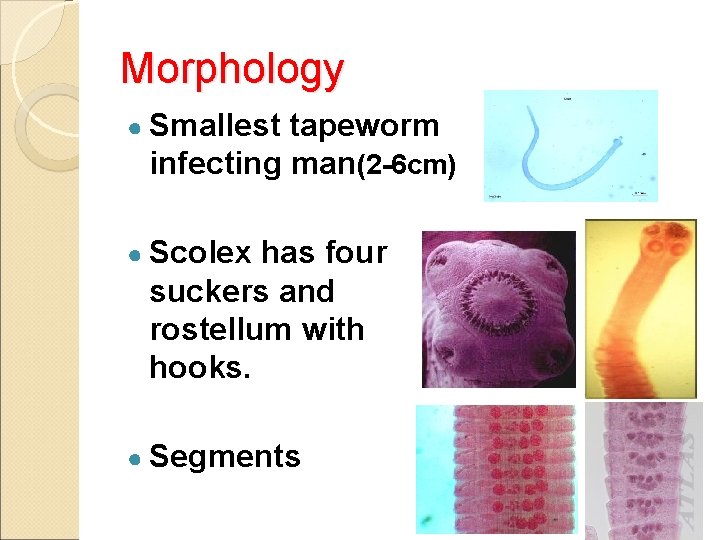 Morphology ● Smallest tapeworm infecting man(2 -6 cm) ● Scolex has four suckers and