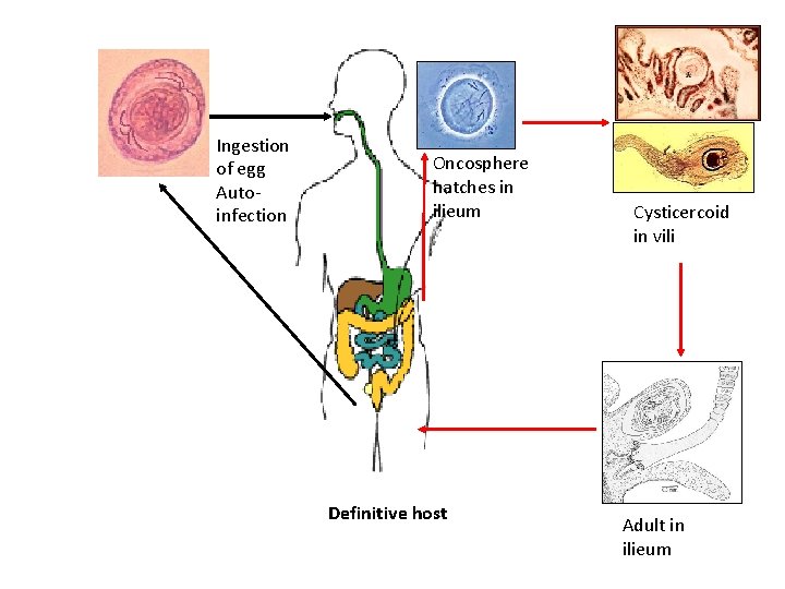 Ingestion of egg Autoinfection Oncosphere hatches in ilieum Definitive host Cysticercoid in vili Adult