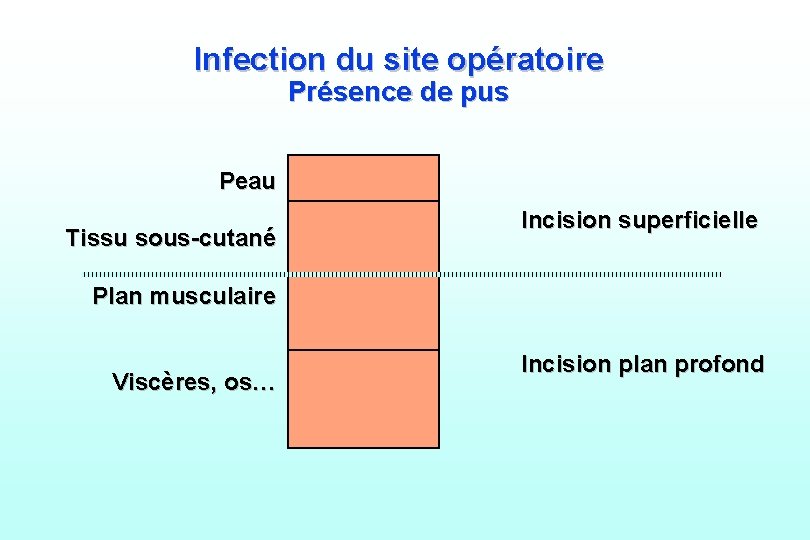 Infection du site opératoire Présence de pus Peau Tissu sous-cutané Incision superficielle Plan musculaire