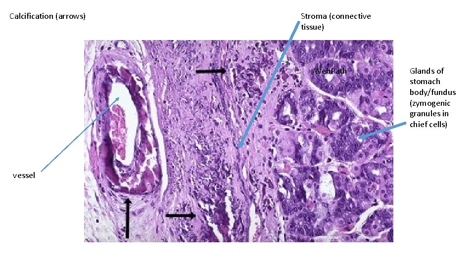 Calcification (arrows) Stroma (connective tissue) Web. Path vessel Glands of stomach body/fundus (zymogenic granules