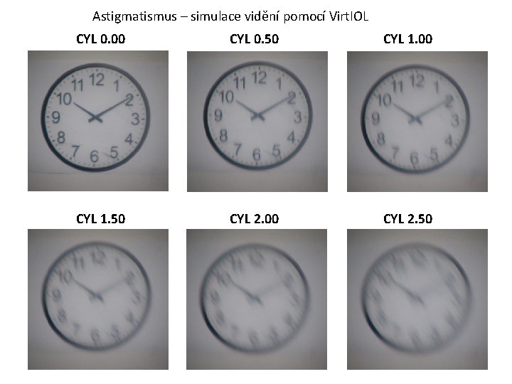 Astigmatismus – simulace vidění pomocí Virt. IOL CYL 0. 00 CYL 0. 50 CYL