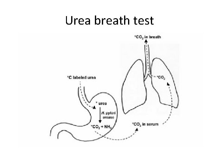 Urea breath test 