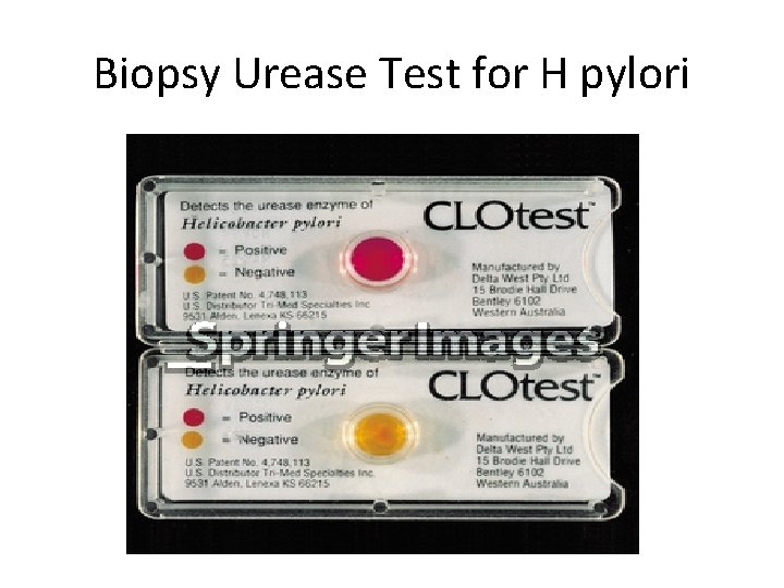 Biopsy Urease Test for H pylori 