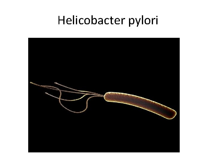 Helicobacter pylori 