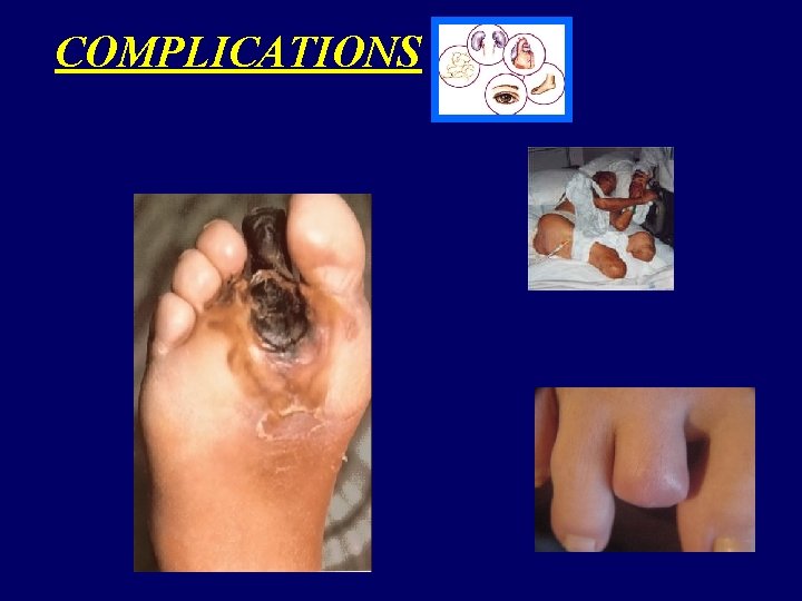 COMPLICATIONS 