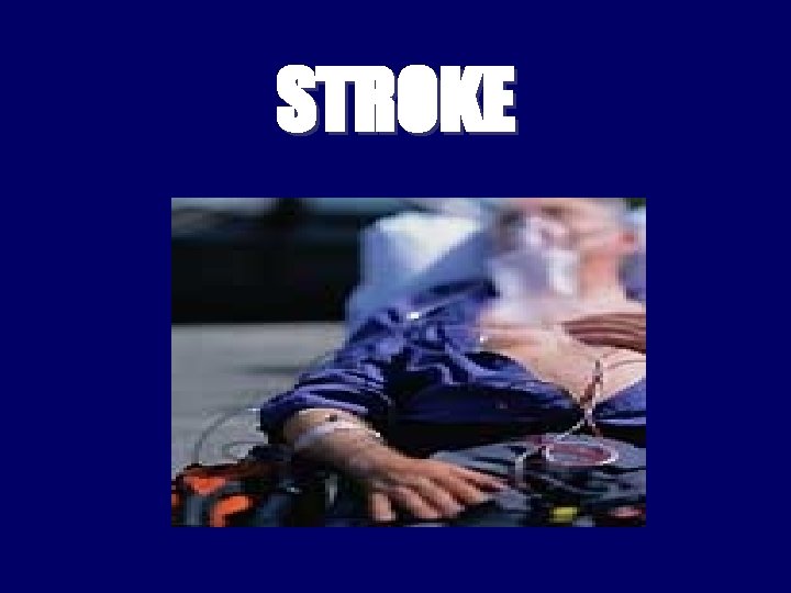 STROKE 