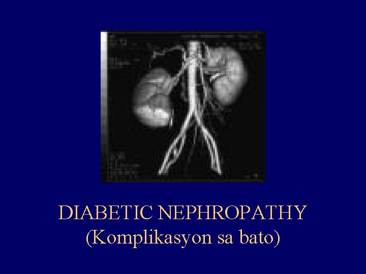 DIABETIC NEPHROPATHY (Komplikasyon sa bato) 