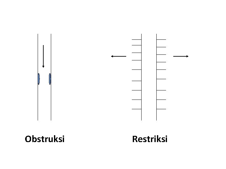 Obstruksi Restriksi 