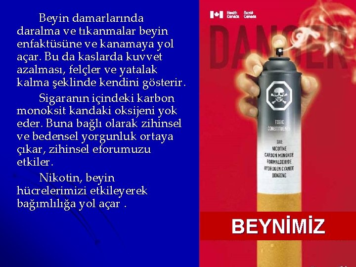 Beyin damarlarında daralma ve tıkanmalar beyin enfaktüsüne ve kanamaya yol açar. Bu da kaslarda