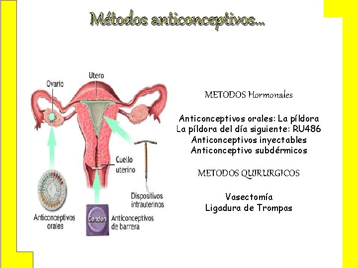 Métodos anticonceptivos… METODOS Hormonales Anticonceptivos orales: La píldora del día siguiente: RU 486 Anticonceptivos