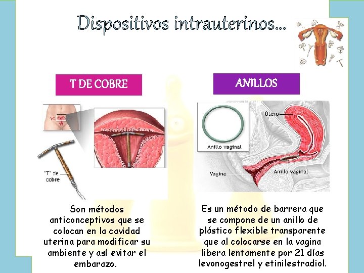 Dispositivos intrauterinos… T DE COBRE Son métodos anticonceptivos que se colocan en la cavidad