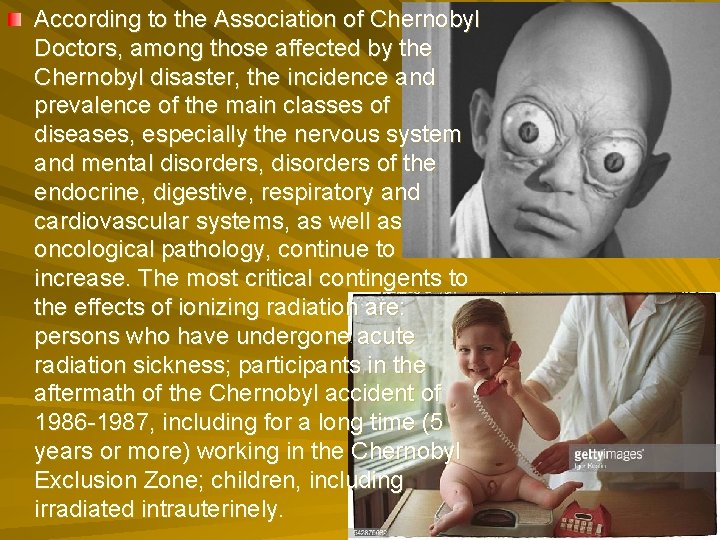 According to the Association of Chernobyl Doctors, among those affected by the Chernobyl disaster,