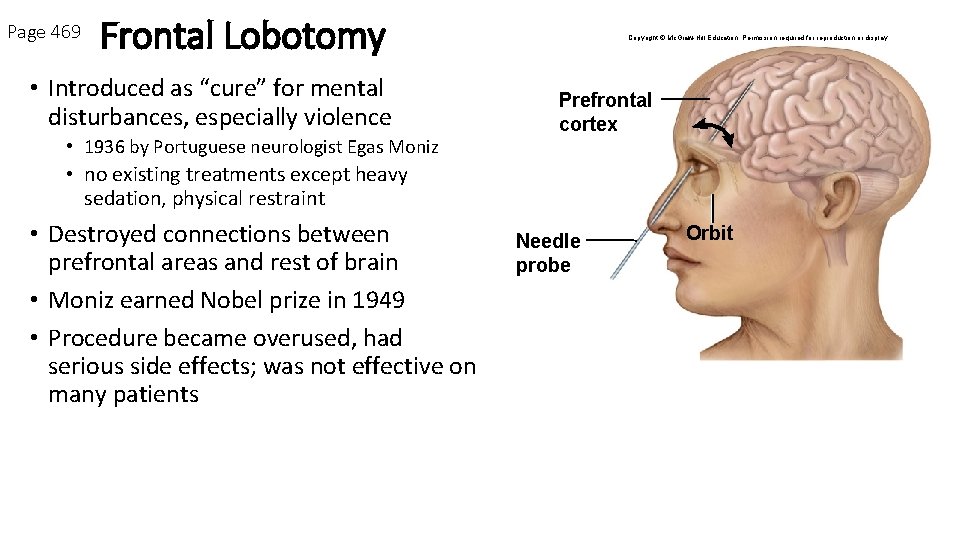 Page 469 Frontal Lobotomy • Introduced as “cure” for mental disturbances, especially violence •