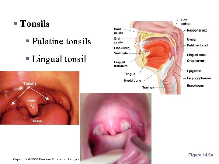 Mouth (Oral Cavity) Anatomy § Tonsils § Palatine tonsils § Lingual tonsil Figure 14.