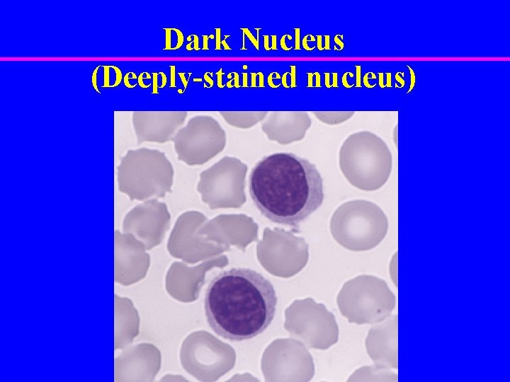 Dark Nucleus (Deeply-stained nucleus) 