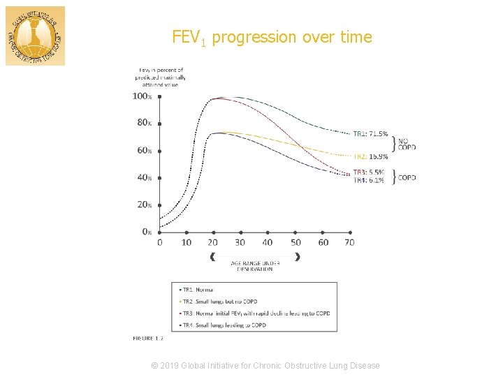 FEV 1 progression over time © 2019 Global Initiative for Chronic Obstructive Lung Disease
