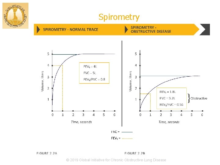 Spirometry © 2019 Global Initiative for Chronic Obstructive Lung Disease 