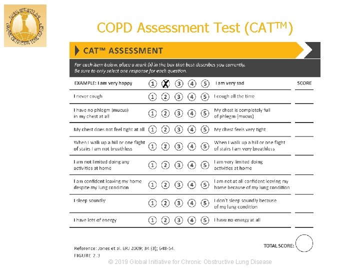 COPD Assessment Test (CATTM) © 2019 Global Initiative for Chronic Obstructive Lung Disease 