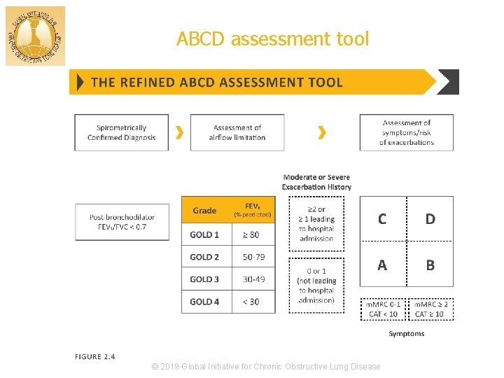 ABCD assessment tool © 2019 Global Initiative for Chronic Obstructive Lung Disease 